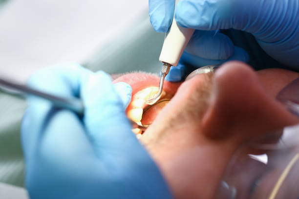 Best Emergency Dental Care for Broken or Chipped Teeth in De Soto, MO